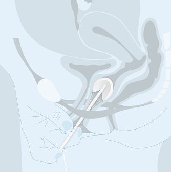 Contrelle Activgard Correct Position Contrelle Activgard Correct Position