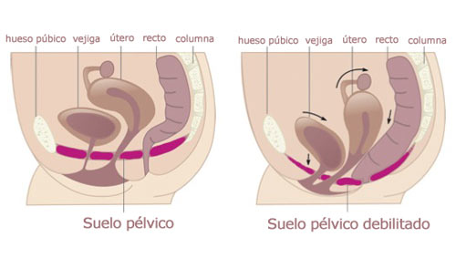 Conos Vaginales LadySystem - Fortalecedores del suelo pélvico | DPM20101000 - Imagen 7
