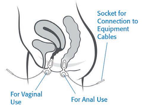 Sonda Anal